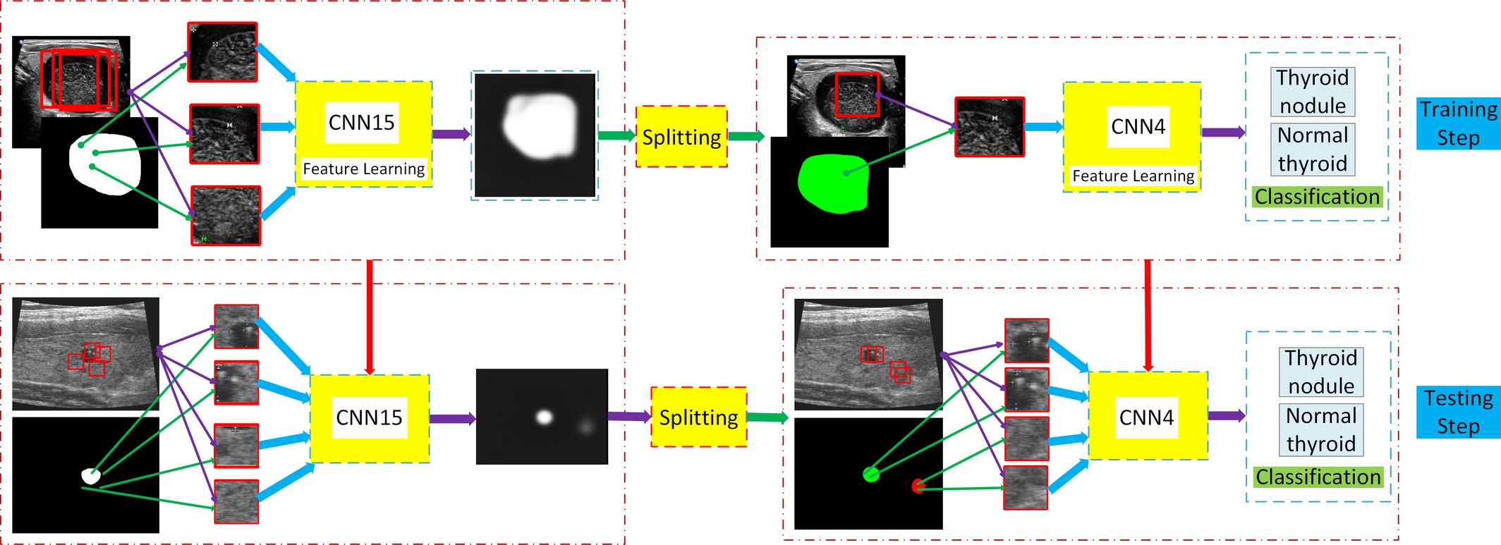 Cascade convolutional neural networks for automatic detection of thyroid nodules in ultrasound images