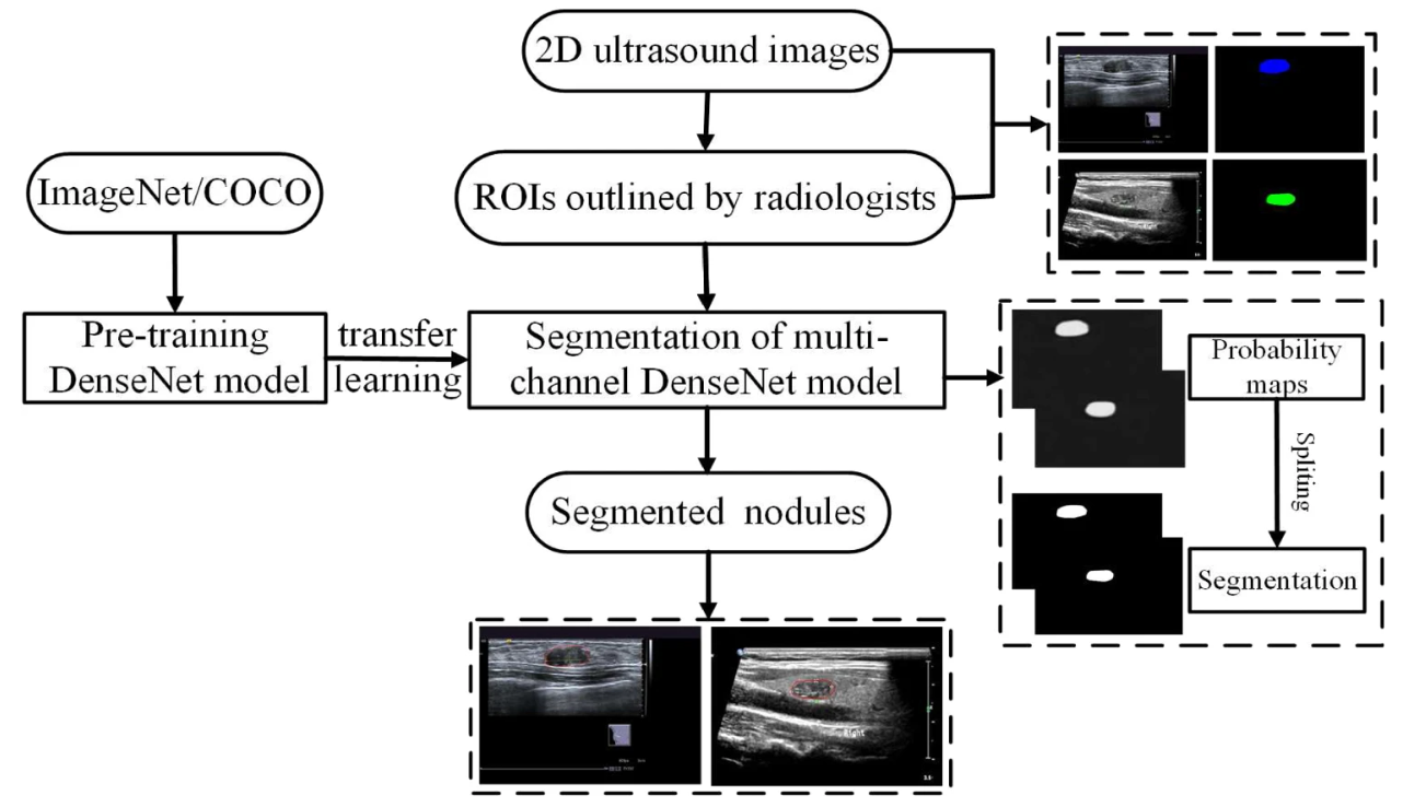 Transfer learning for automatic joint segmentation of thyroid and breast lesions from ultrasound images