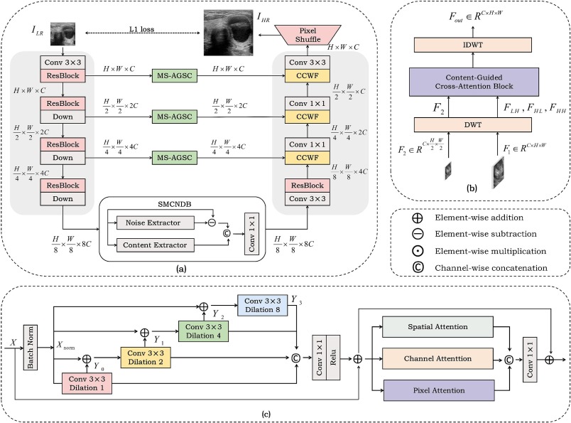 MWCFNet: Multiscale wavelet cross-attention fusion network for ultrasound image super-resolution via content-noise decoupling
